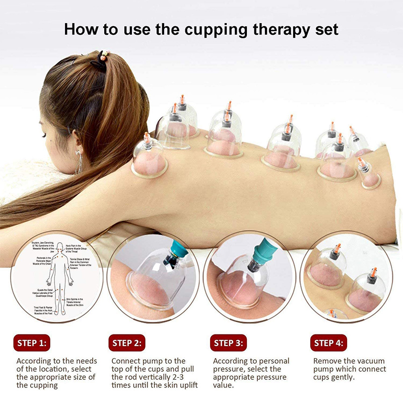 6or24  Pieces Suction Cups Mas - Cupping Therapy Set review and price
