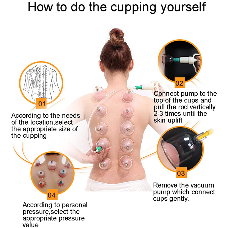 6or24  Pieces Suction Cups Mas - Cupping Therapy Set review and price