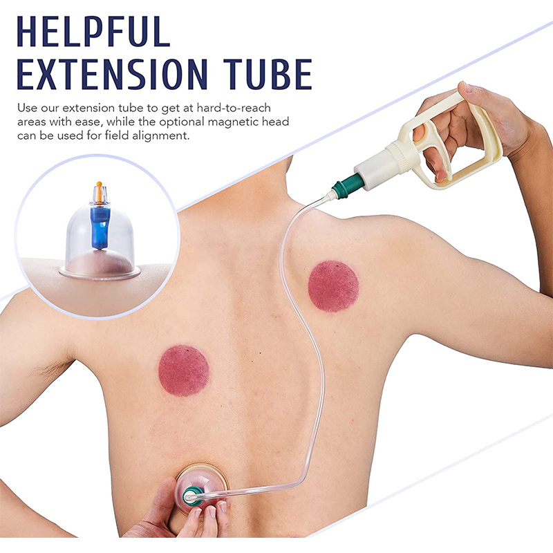 6or24  Pieces Suction Cups Mas - Cupping Therapy Set review and price