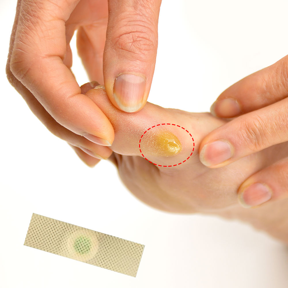 60Pcs Foot Care Medical Patch  - Detox Foot Patch review and price