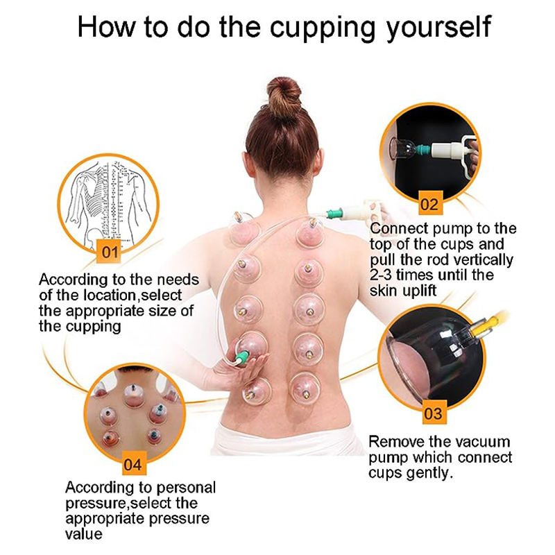 24 Cans JINGKANG Chinese Vacuu - Cupping Therapy Set review and price
