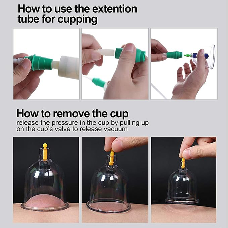 24 Cans JINGKANG Chinese Vacuu - Cupping Therapy Set review and price