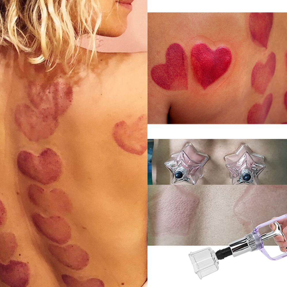 New Style 4 PCS Love-star Shap - Cupping Therapy Set review and price